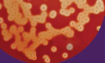 Bacterial colonies on a HiMedia agar plate